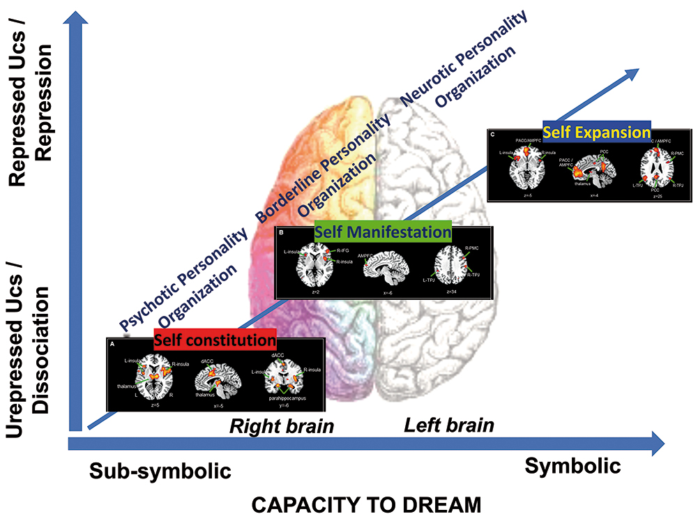 The Sleeping Brain Suppresses External Inputs When Dreaming, But Not During All  Sleep
